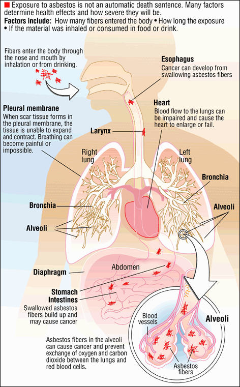 Asbestos Health Risks